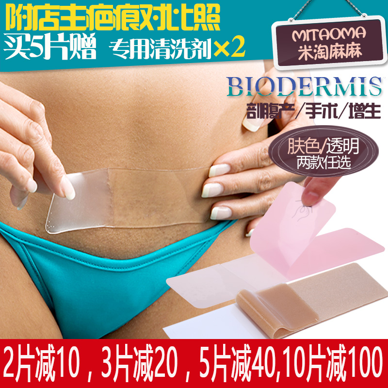 美国3M剖腹产免缝胶带美容胶布术后疤痕修复