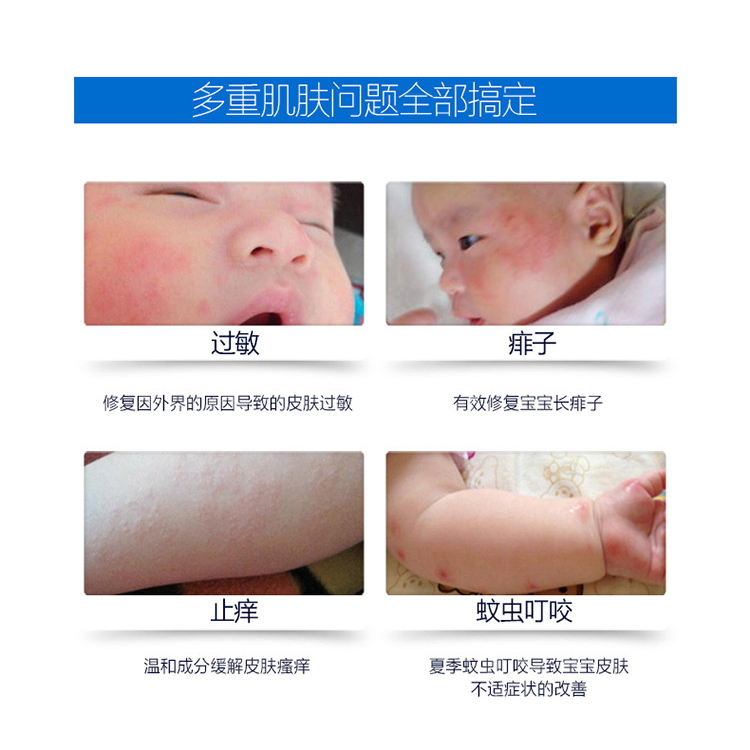 北京协和八韵草本草肤乐霜护理霜正品婴儿宝宝新生儿童湿疹无激素
