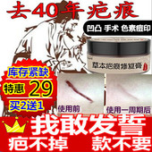 疤痕灵祛除黑色素沉淀修复膏手术刀疤凹凸疤痕疙瘩伤疤祛痘印正品