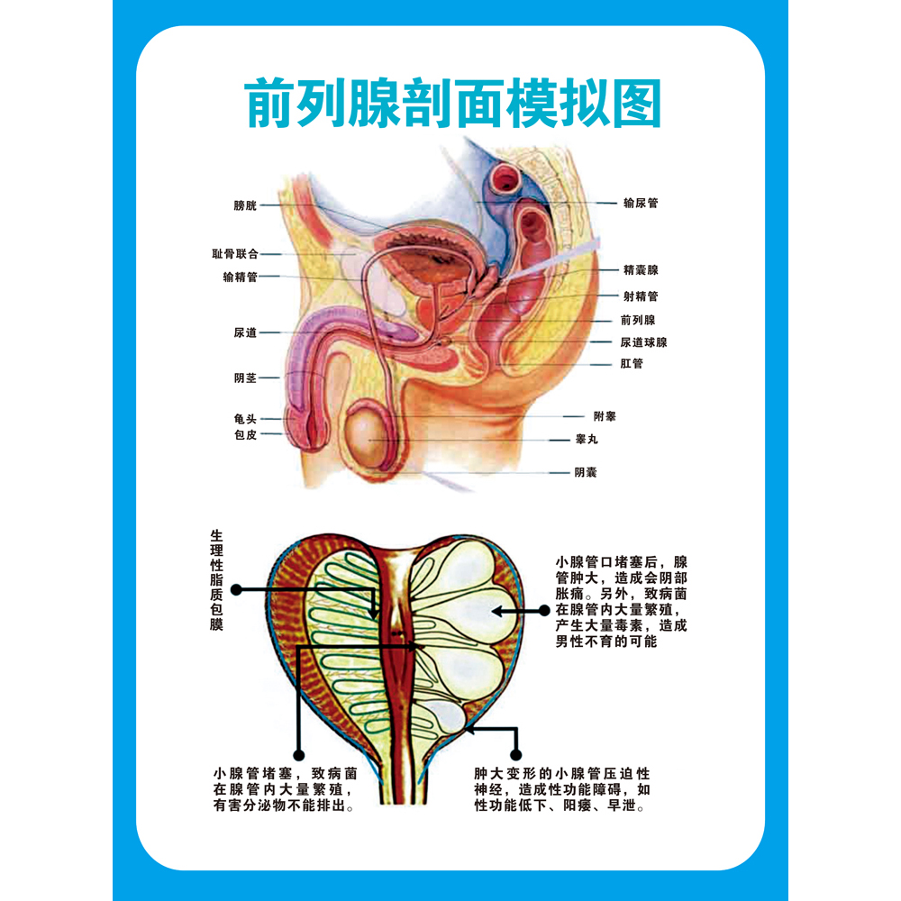 男性生殖系统睾丸阴茎示意图医学宣传挂图人体器官解剖图医院布置