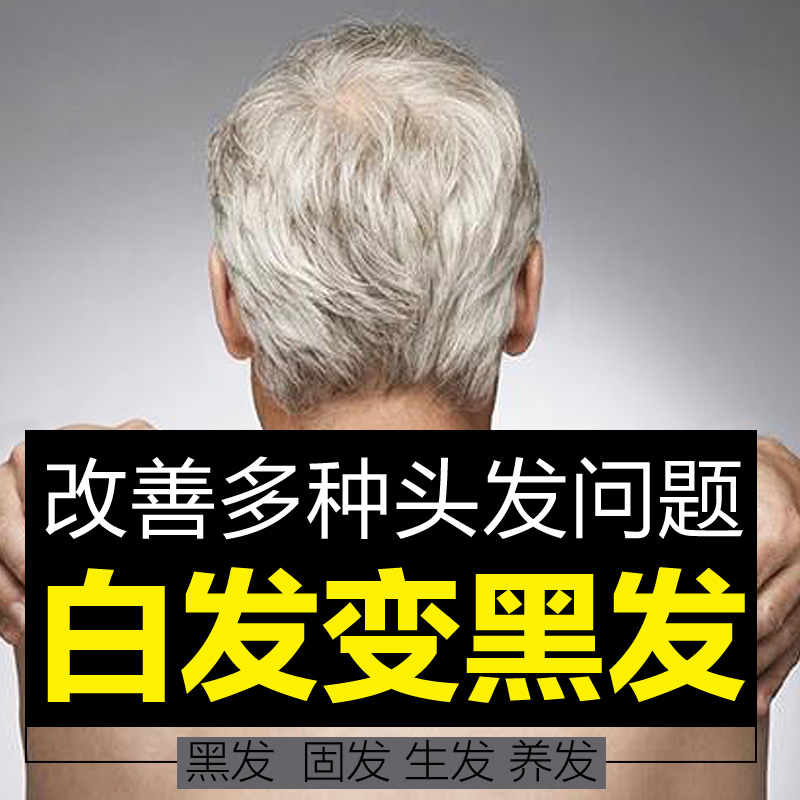 乌密汤增发乌发茶乌发育发脱发止脱发白头发变黑发制何首乌粉