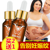 孕妇产后去除妊娠纹祛肥胖纹橄榄精油消除淡化妊辰纹修复霜收腹