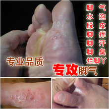 脚气膏治脚气真菌感染脱皮糜烂脚丫型水泡止痒杀菌药膏特效喷剂