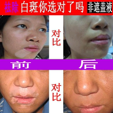 白柏呔话遵卜柚伟椎罘缈诵峭庥眯薷窗遵帮L特效非遮盖液药膏黑色素