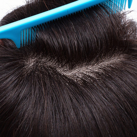 [女士头顶补发]评价 女士头顶脱发怎么样