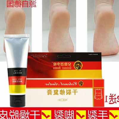 脚裂膏特效治手裂脚后跟干裂口子药灵霜裂净手