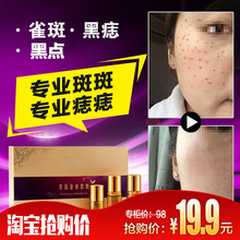祛肉痣雀斑痦子苍蝇屎点斑水 美容金水黑痣膏点凸痣药水无痕正品