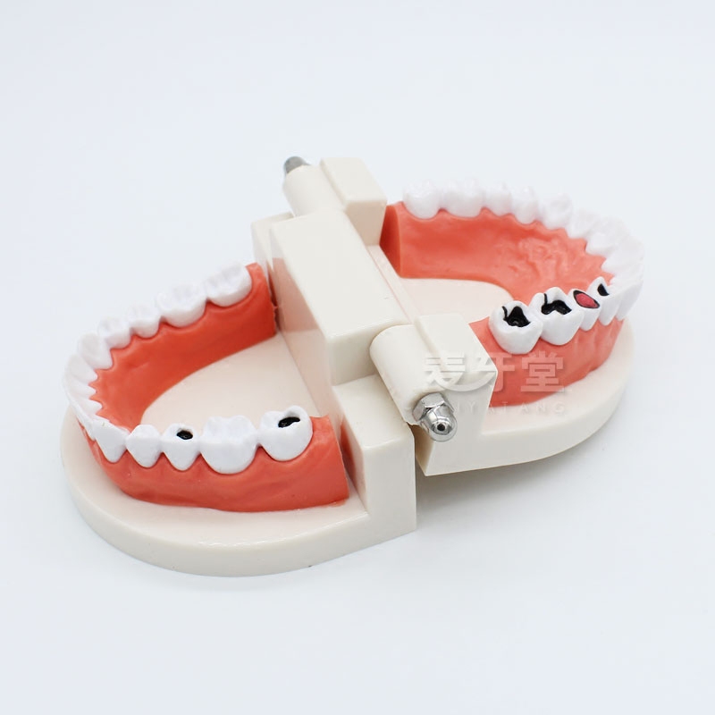 麦牙堂牙科牙齿病理模型成人全口牙模型医患沟通教育教学1倍牙模