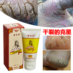 七安堂手足皲裂膏手裂脚裂口防裂膏手脚开裂龟裂脚后跟脚干裂脱皮