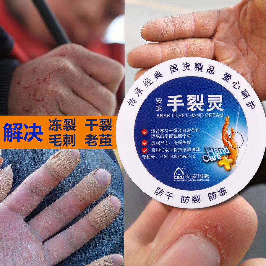 安安防冻疮膏防冻霜防干裂保湿滋润冬季护手霜男爆拆灵手裂灵正品